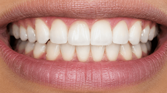 Prótesis fija Zirconia — después