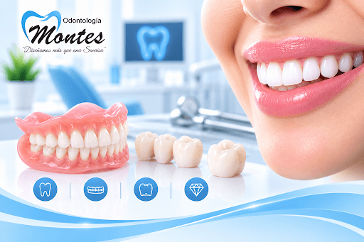 Prótesis dentales